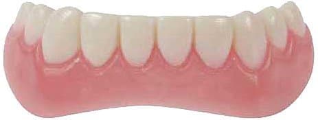 Hollywood Quality Lower Veneer by instantsmile