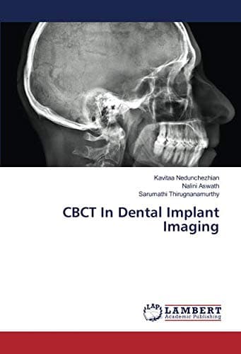 CBCT In Dental Implant Imaging