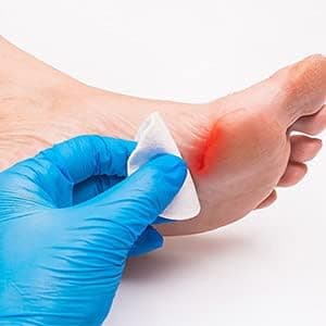 Globe 3'' x 3'' Advanced Sterile Gauze Pads, 100-Pack Individually Packed - 12-Ply Cotton for Wound Care Dressing, Highly Absorbent Bandages for Home & Emergency Use - Travel & First Aid Kit Essential