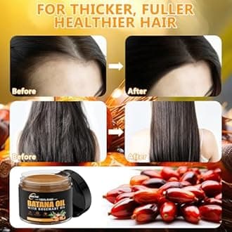 Raw Batana Oil for Hair Growth,Rosemary Oil,100% Natural Pure Dr. Sebi Batana Oil from Honduras,Unrefined Organic Batana Oil Hair Growth Oil for Prevent Hair Loss 5.3 oz