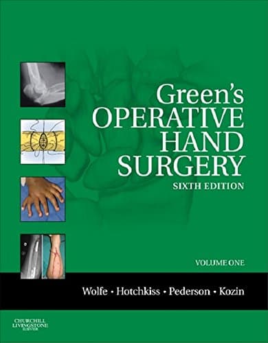 Green's Operative Hand Surgery: The Pediatric Hand E-Book: Expert Consult: Online and Print (Greens Operative Hand Surgery)
