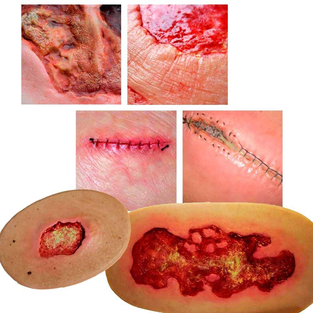 Erler Zimmer Surgical Wound Freshly Stapled Wound Simulation Artificial Wound