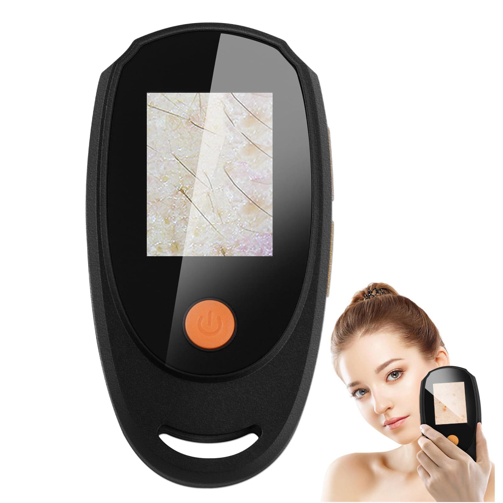 Dermatoscope Scalp Camera, Skin Analysis Machine, Handheld 2-in-1 Observer fo...