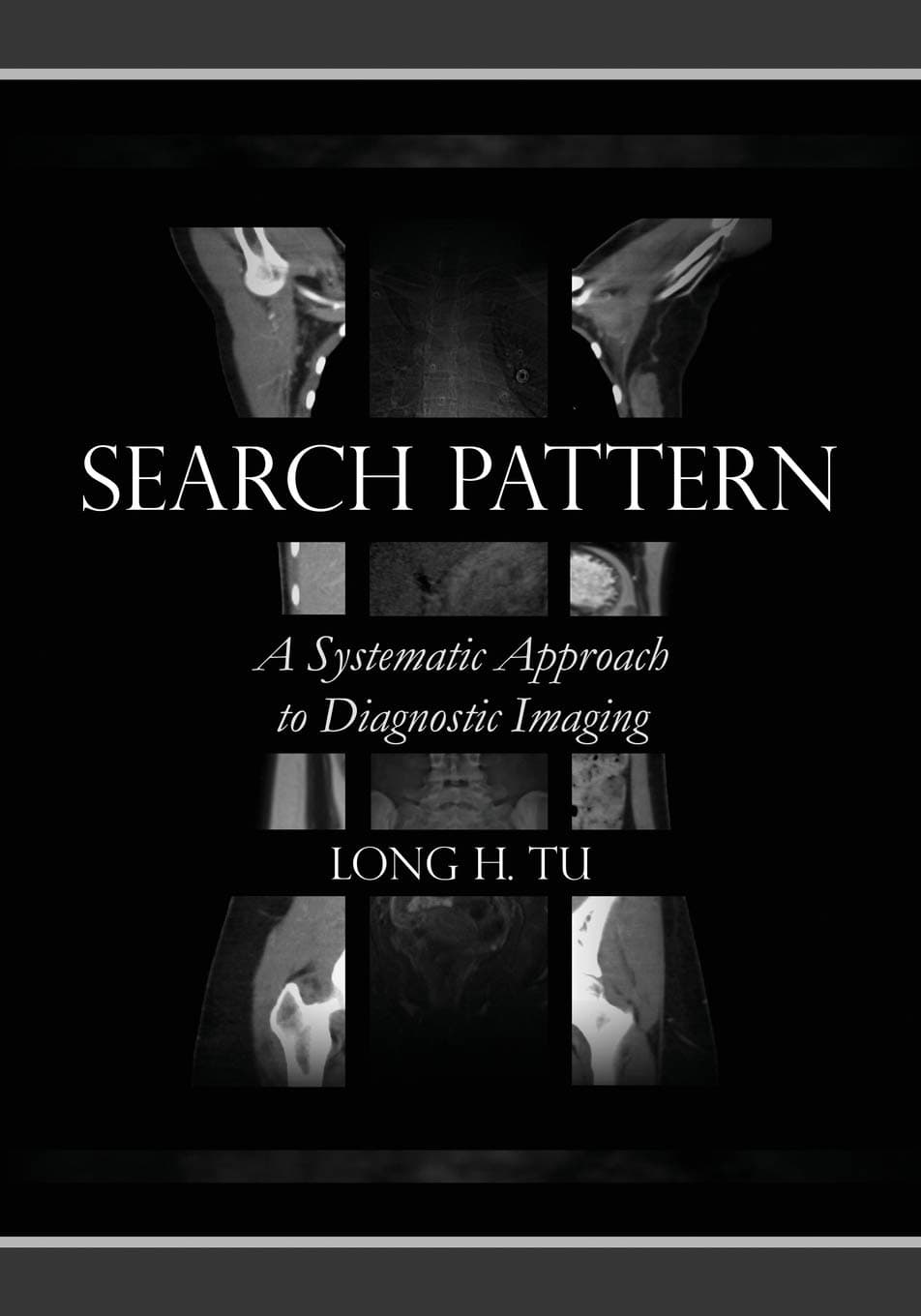 Search Pattern: A Systematic Approach to Diagnostic Imaging Paperback – 30 Jun. 2020