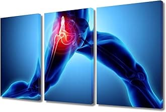3 Panel X Ray Fitness Center Modern Artwork Wall Decor Poster 3D Modern Artwork Skeleton X-Ray Pictures for Bedroom Giclee Wooden Framed Gallery-Wrapped Ready to Hang 36" Wx24 H
