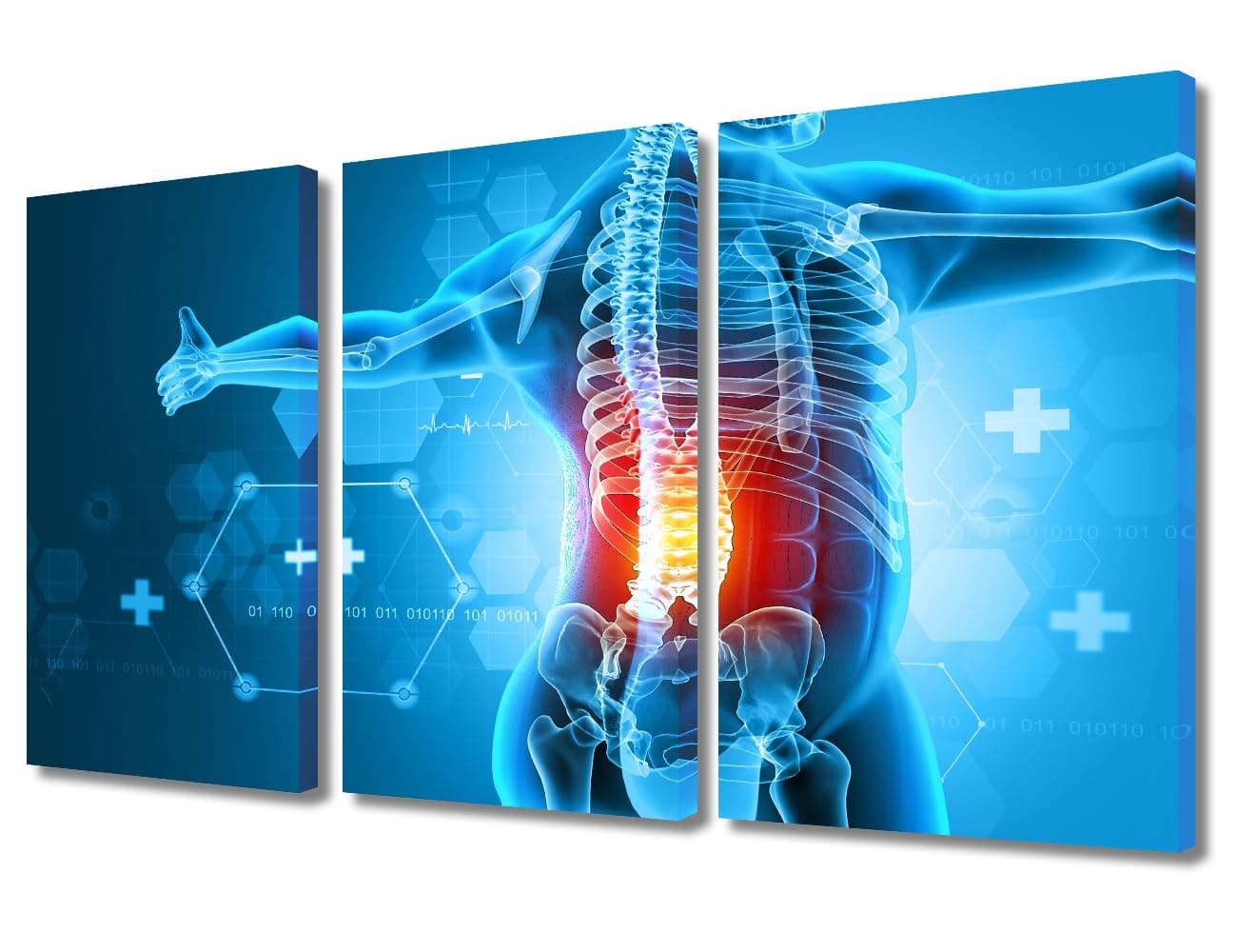 3 Panel Human Backache and Back Pai Poster Pictures for Bedroom Medical Health Care Concept Wall Decoration for Living Room Giclee Wooden Framed Gallery-Wrapped Ready to Hang 36" Wx24 H