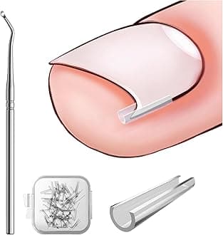 BEZOX Ingrown Toenail Corrector Set - 40 Pcs Pain-Free Toenail Straightener Strips with Toenail Lifter - Easy Use Ingrown Toenail Tools Kit