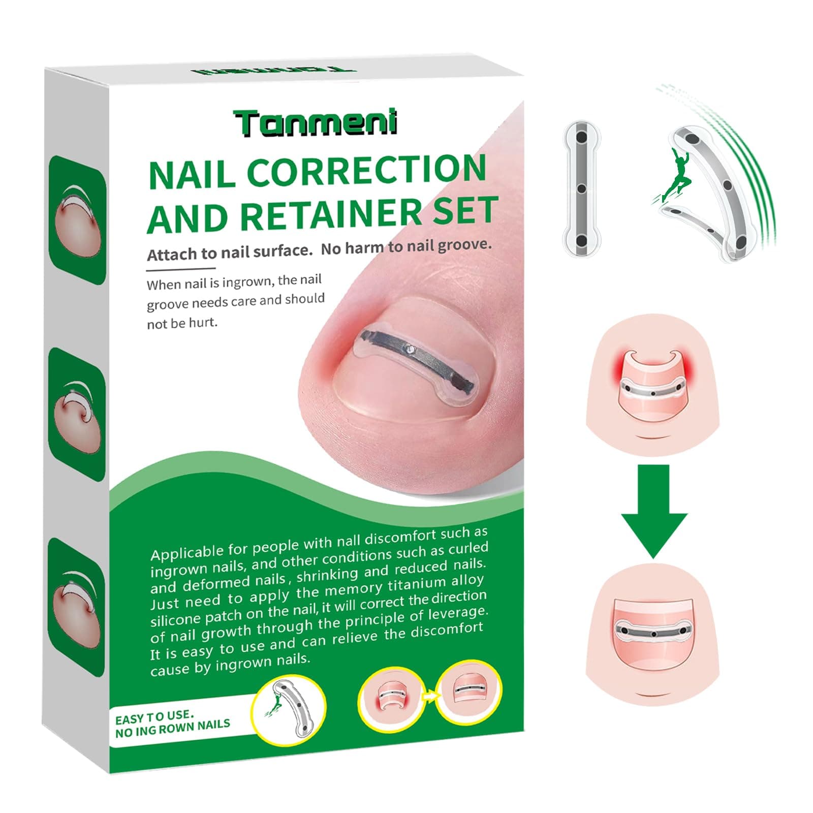 Titanium Alloy Silicone Ingrown Correction Patch Tool,Ingrown Toenail Treatment,Ingrown Toenail Removal Kit,Designed for Ingrown Nail Repair,Ingrown Toenail Corrector,Applicable to men and women