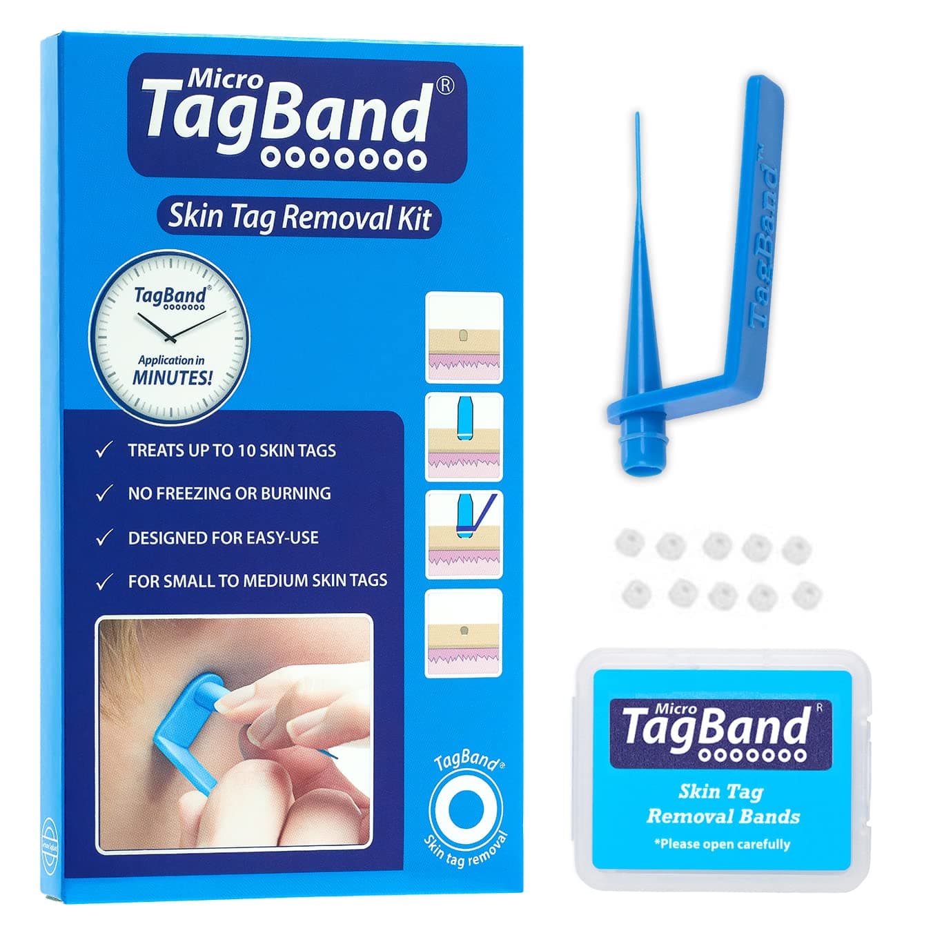 Micro Tag Band Skin Tag Remover Device For Small To Medium Skin Tags