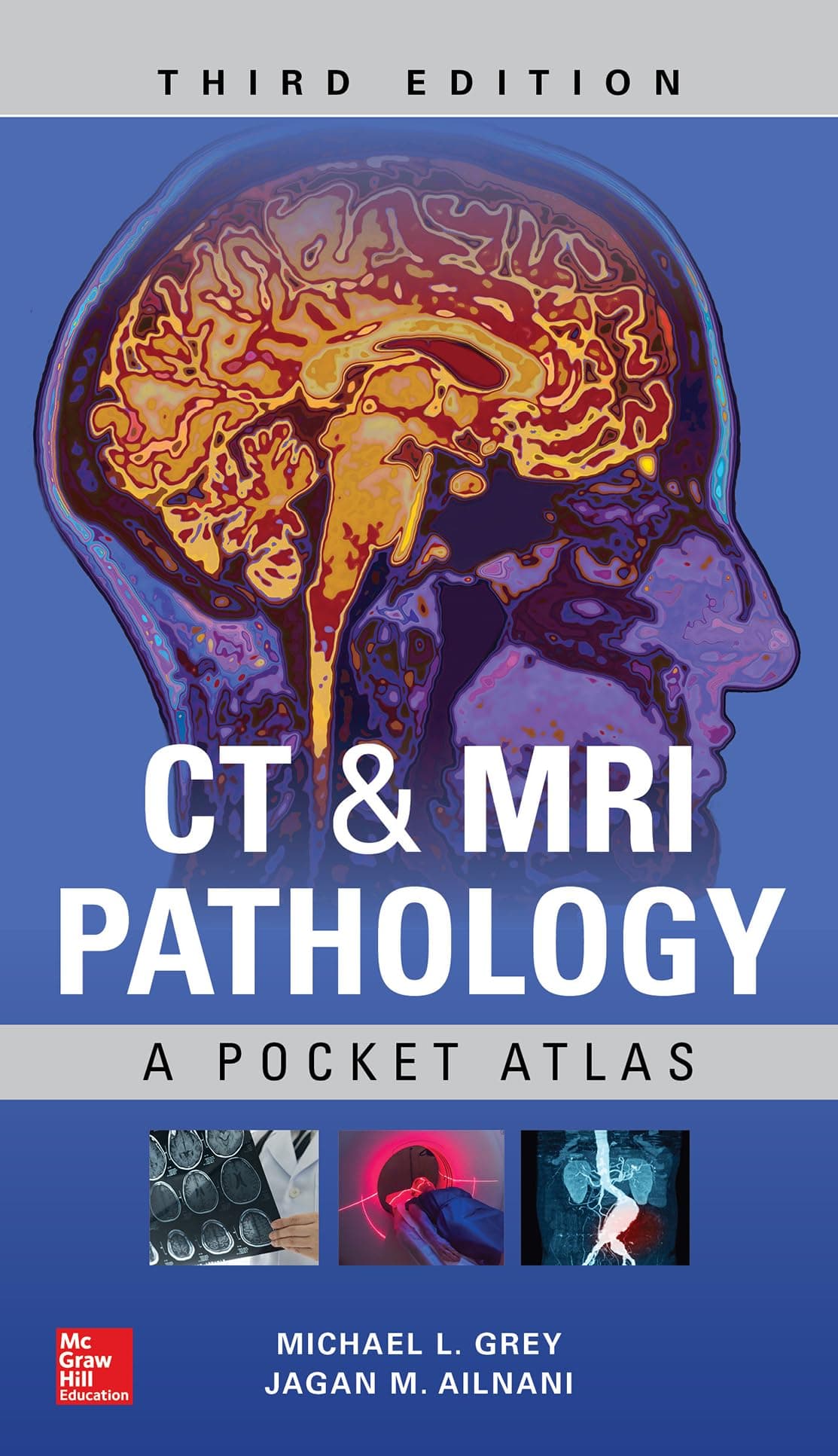 CT & MRI Pathology: A Pocket Atlas, Third Edition (RAD TECH)