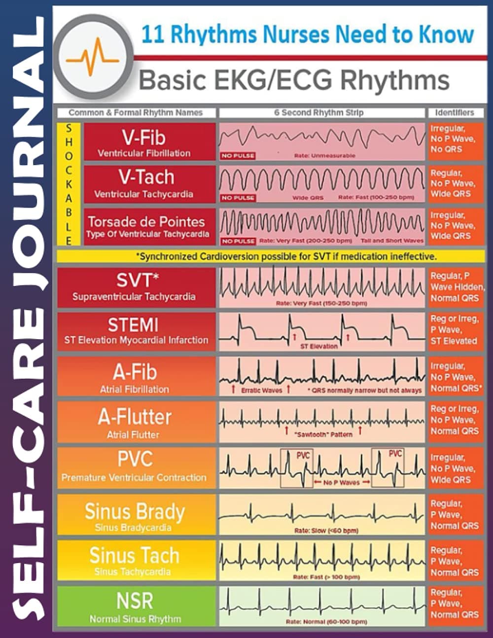 Self-care Journal: Nurse basic ekg ecg rhythms Invest 5 minutes daily to Physical, Mental and Emotional Health Planner, To Do Tracker Notebook Record Book with Check List Organizing, Tear Off, Simple Script, College Ruled 110 Pages Undated Paperback – September 30, 2021