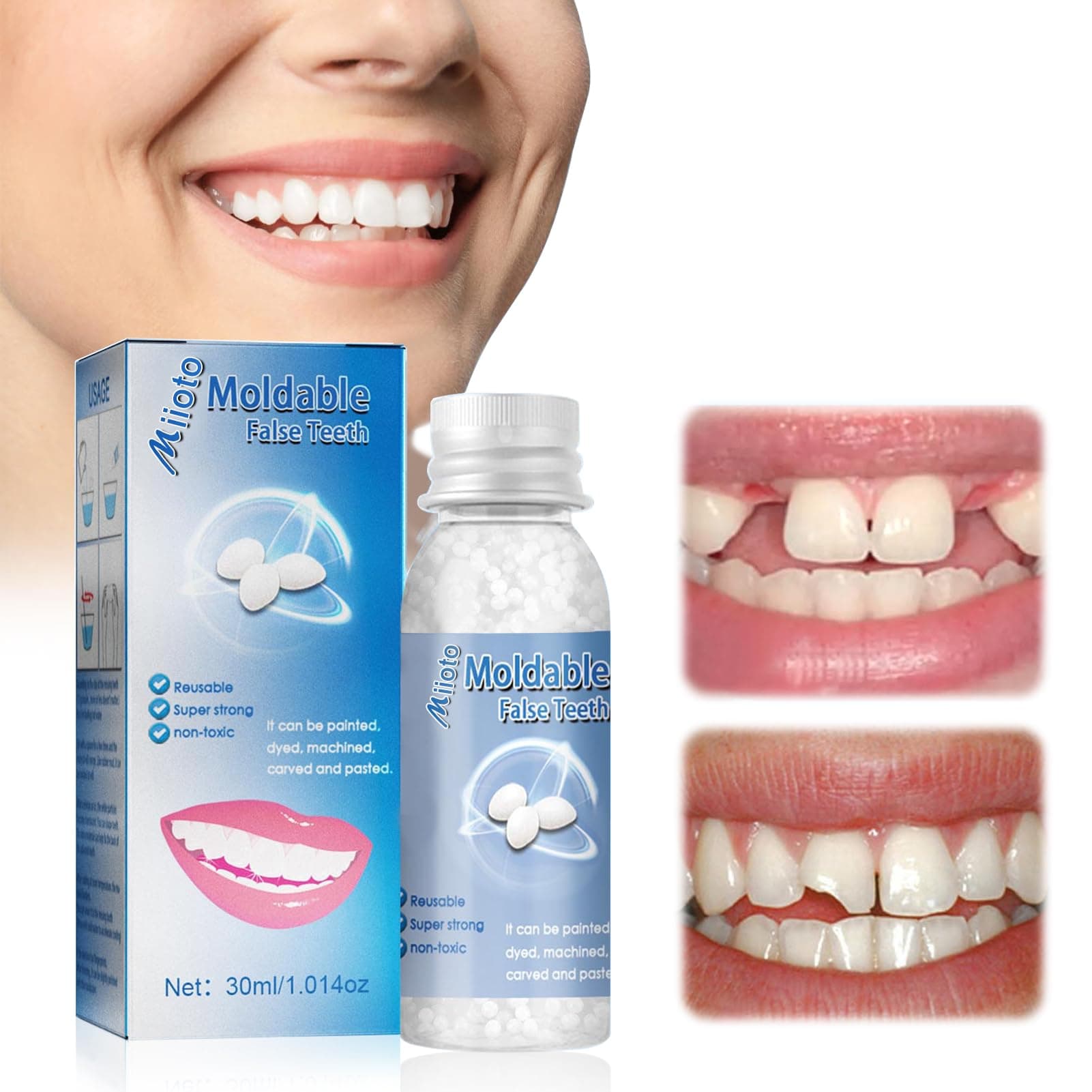 Ganbaro Moldable False Teeth Tooth Repair Granules, Teeth Repair Kit, DIY Temporary Tooth Repair Beads, for Temporary Fixing The Missing and Broken Tooth Replacements