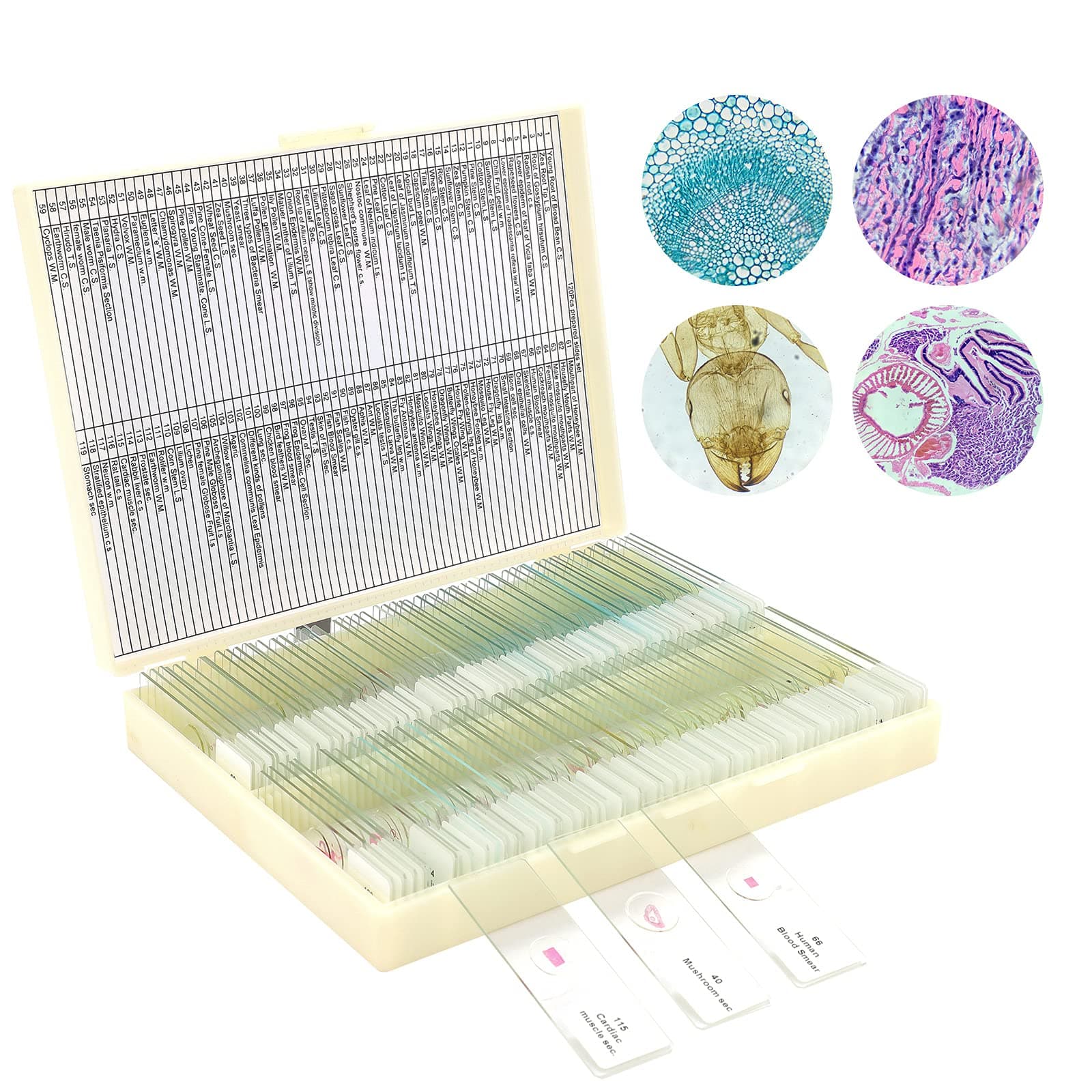 120 Microscope Slides with Specimens