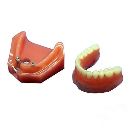 Dental Study Teaching Model Teeth Implant Repair Model For Dentist