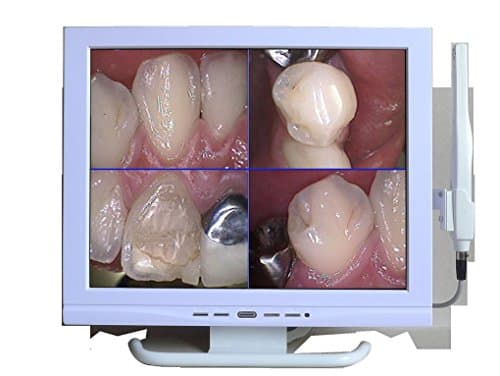 Brand New ORC-01A Multi-Media Dental Camera with Sony HAD CCD Image Sensor and Color 15 inch 4:3 Monitor
