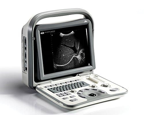 SonoScape A6 Portable Digital OB / Gyn or MSK / Podiatry System NEW