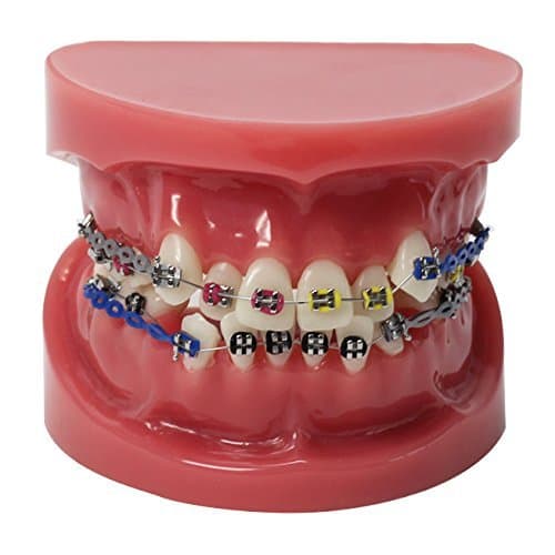 New Teeth Malocclusion Correct and Brackets Teeth Hoop Standard Simulation Model M3005
