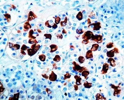 RP 045-05 - Adenocorticotrophic Hormone (Acth), Concentrated Polyclonal - Rabbit Polyclonal Adrenocorticotropic Hormone (Acth), Diagnostic Biosystems - Each