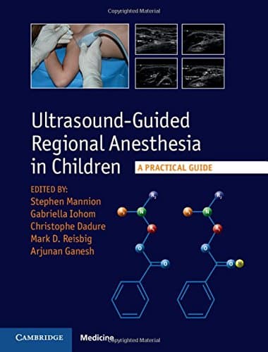Ultrasound-Guided Regional Anesthesia in Children: A Practical Guide