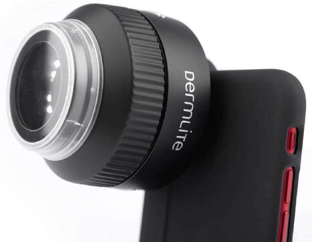 3Gen DermLite FOTO Digital Epiluminescence Microscopy System