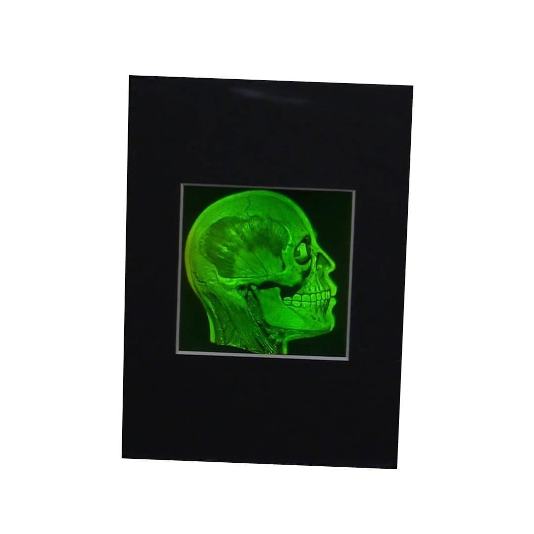 Brain/Skull (Anatomically Accurate) True 3D Photopoloymer Realistic 2-Channel 3D Hologram Picture (Matted Only)