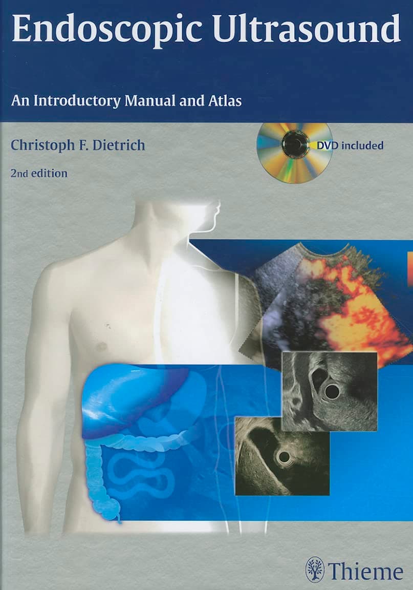 Endoscopic Ultrasound: An Introductory Manual and Atlas