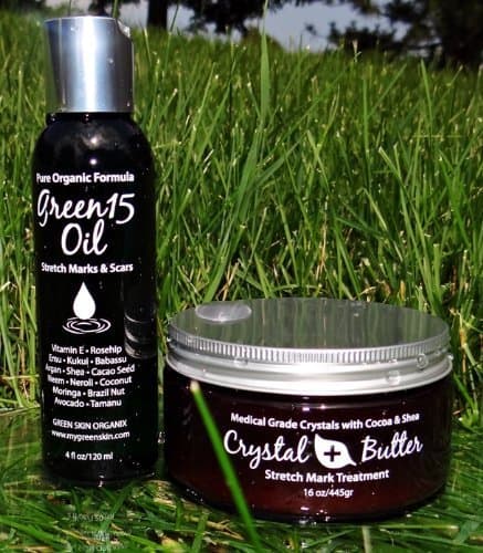 Best STRETCH MARK Complete Solution Kit- Medical grade microdermabrasion crystals mixed with Raw Cocoa Butter +organic 15 natural oils blend Stretch Mark COMPLETE KIT Microdermabrasion Crystal Butter & Green15 Oil shown to prevent and remove old stretch marks, microdermabrasion crystals exfoliate dead scars and stretch marks, stretch mark oil nourishes and repairs broken skin