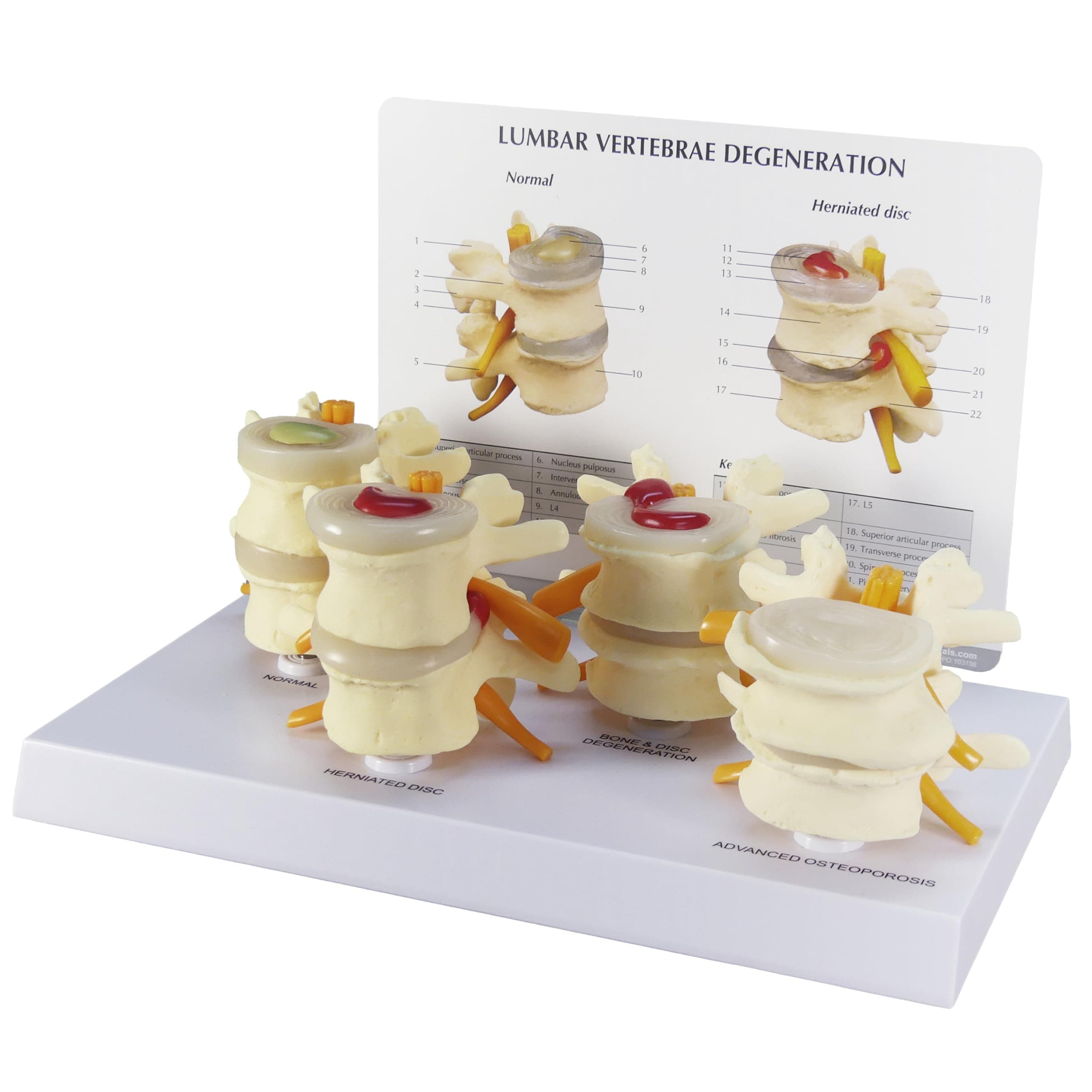 GPI Anatomicals - 4-Stage Vertebrae Model, Spine Model for Human Anatomy and Physiology Education, Anatomy Model for Doctor's Office and Classrooms, Medical Learning Resources