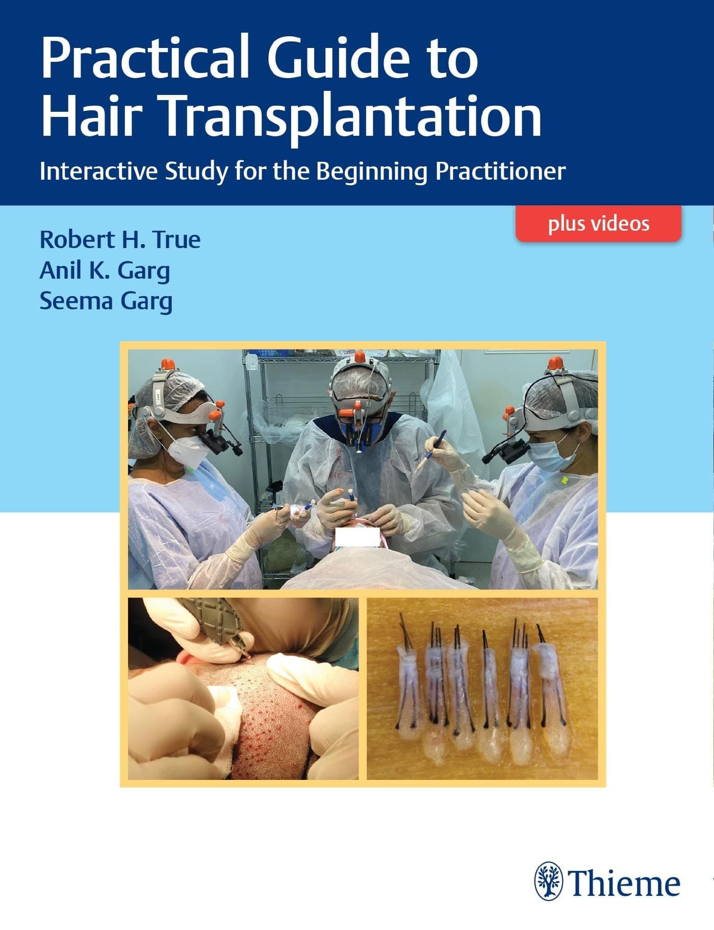 Practical Guide To Hair Transplantation Interactive Study For The Beginning Practitioners (Hb 2021)