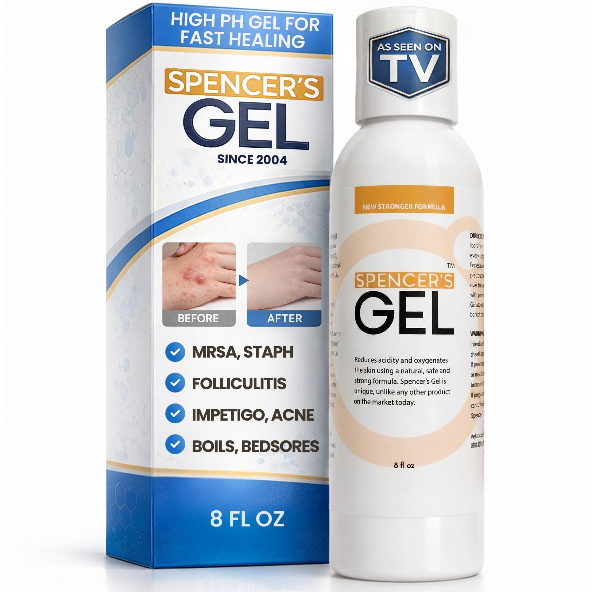 Spencer's Gel Alkaline Formula (8oz) - lab-certified to kill Staph aureus on skin contact