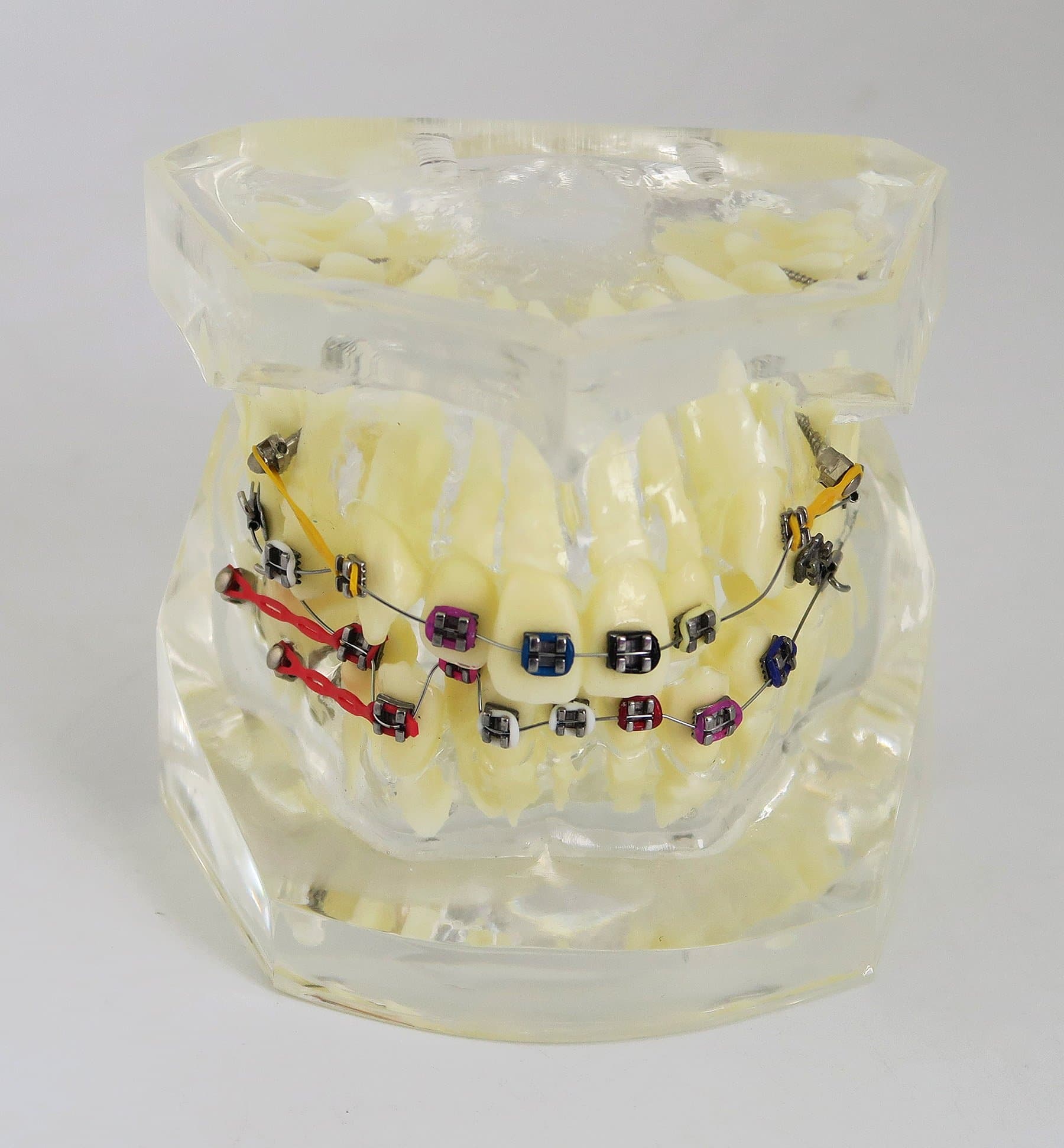 Teeth Orthodontic Model Dentist MultipleTreatment Dental Teach Model